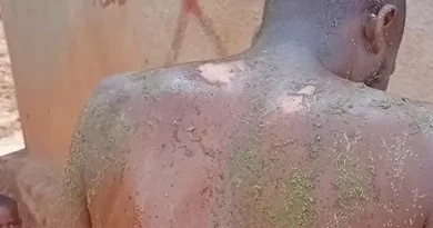Kigali:Umugore yuhagije umugabo we isombe  irikotsa